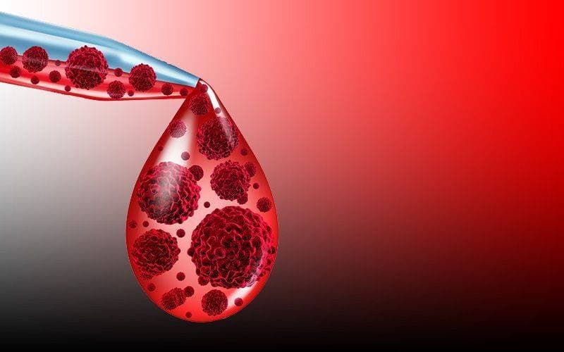 Bone Marrow Transplant in Turkey