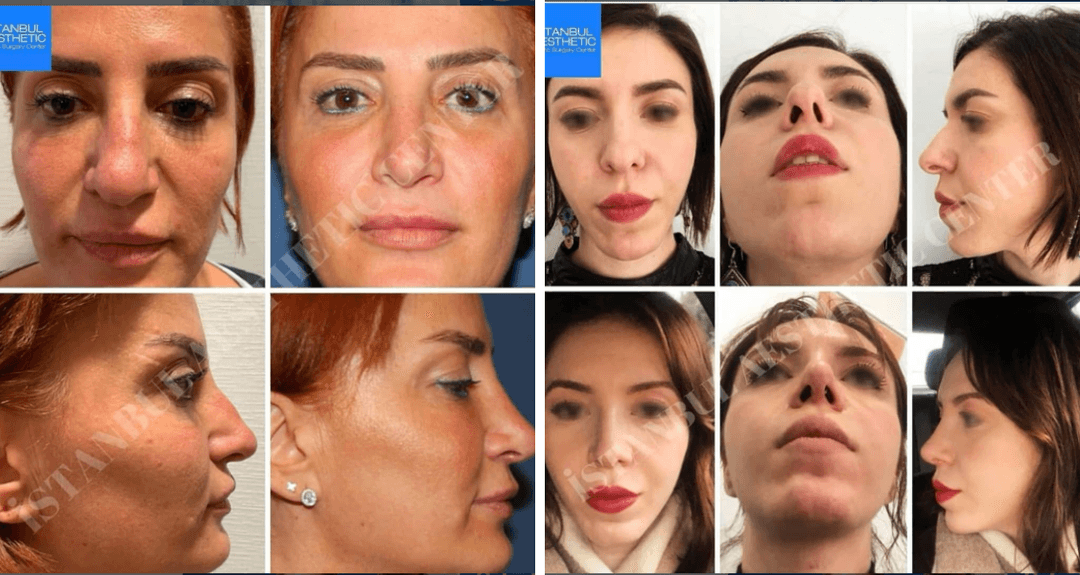 Before/After image 1
